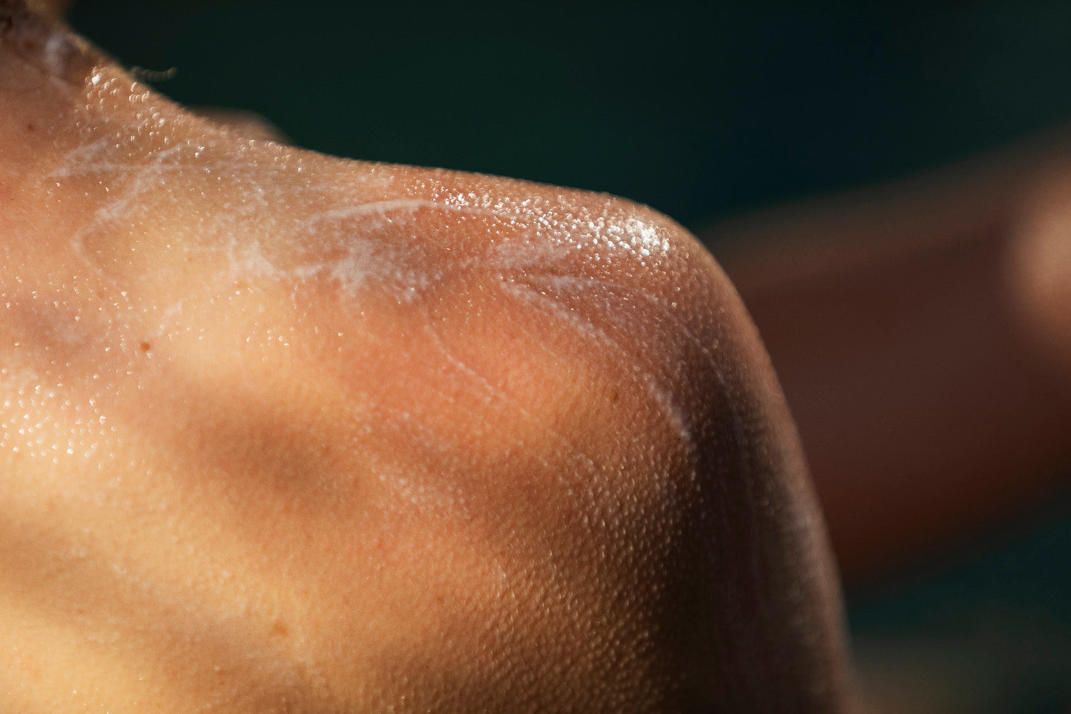 BAKUCHIOL VS RETINOL